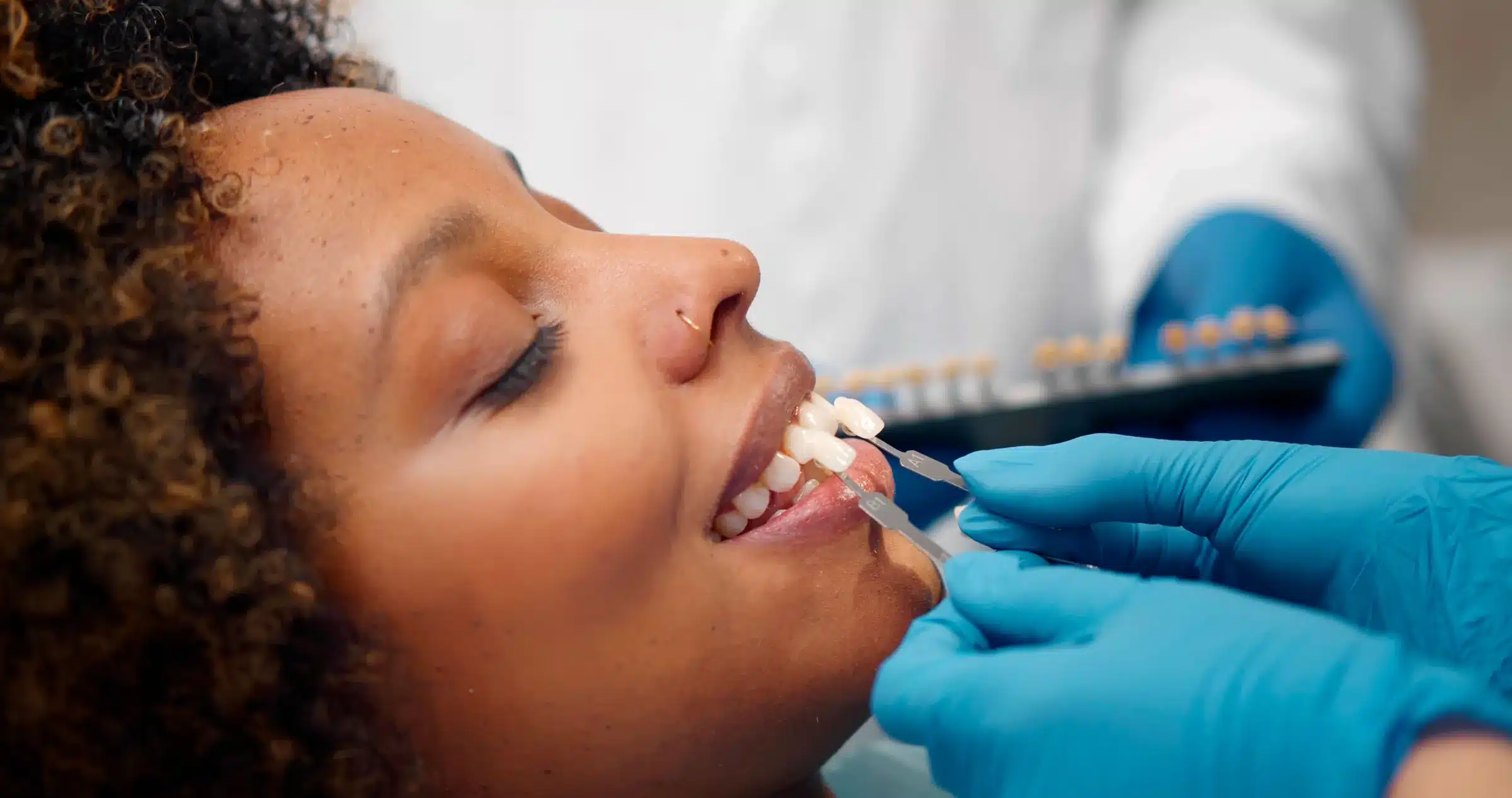 Natural Looking Porcelain Veneers, Nairobi